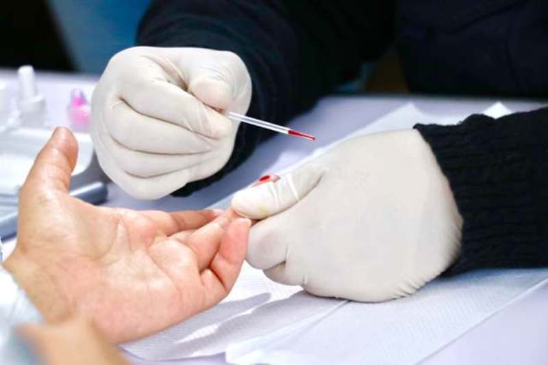 Gobierno reafirma compromiso con prevención del VIH y reactivación del COESIDA