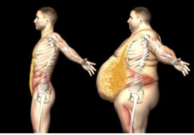 En 2035 la mitad del mundo podría ser obesa