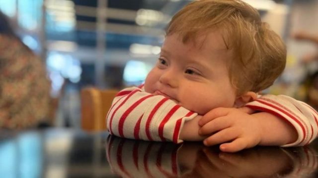 Síndrome de Down: «El problema no es el niño (…) Lo que hace nuestra vida más difícil es la sociedad, la falta de entendimiento y el miedo a la diferencia»