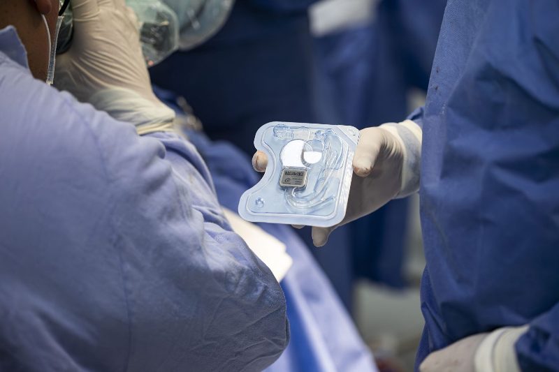 Implante coclear en UMAE Hospital de Pediatría SXXI del IMSS devuelve percepción sonora a niño con hipoacusia profunda bilateral